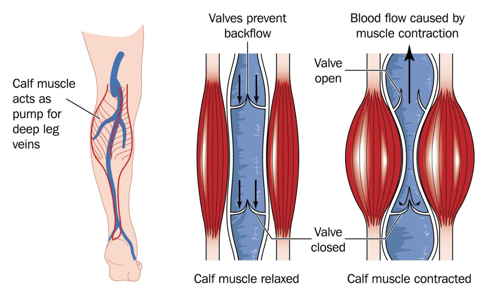 Diagram Of Blood Flow In The Legs Venous Insufficiency Chron