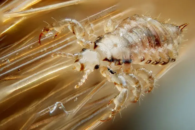 Best Effective Head Lice Treatments Expert Health Reviews